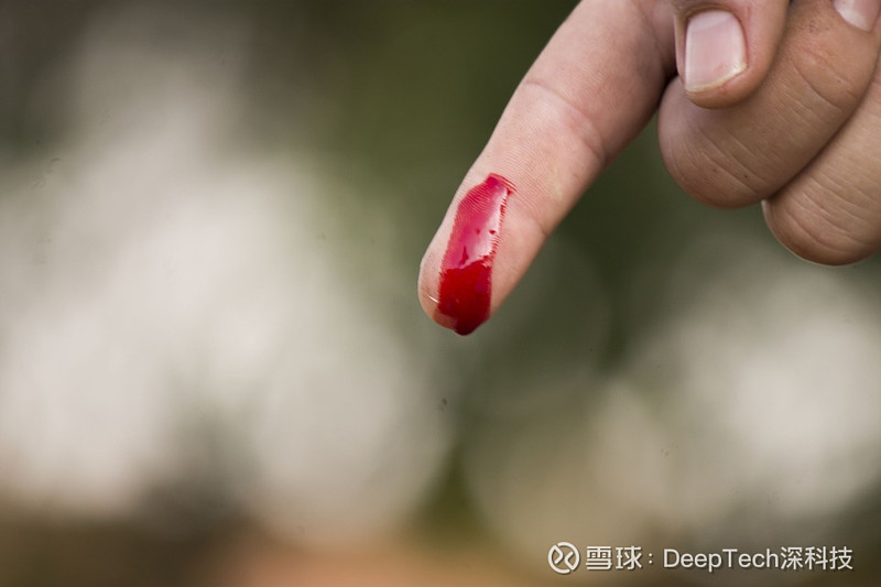 上海交大团队制备快速高效和伤口愈合设备,止血时间低于20 秒