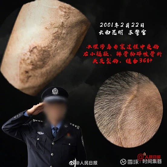 人民日報公佈的一組禁毒民警的傷疤中,槍傷,捅傷,砍傷,摔傷,撞傷.