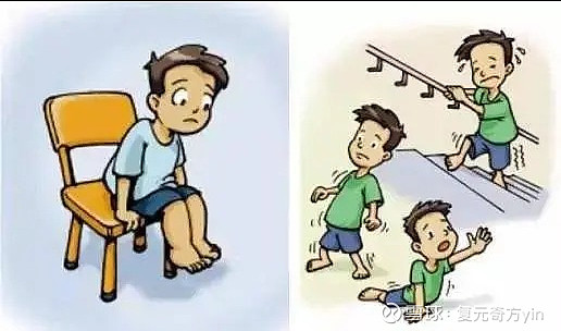 进行性的营养不良症,临床特征为进行性加重的肌肉萎缩和无力,这属