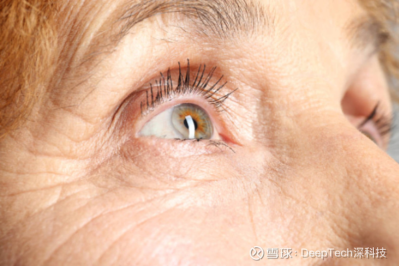 不戴眼镜也能看清东西全球首款老花眼滴眼液获fda批准每次使用效果可