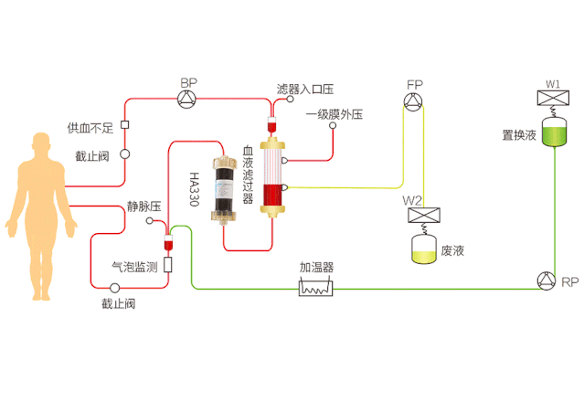 健康科技生命风帆血灌行业现状及竞争力分析健帆生物的投资价值分析二