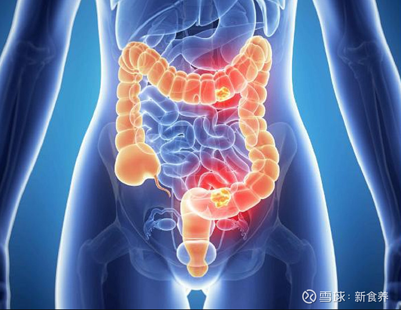 生活中常见的17种有益肠道健康含有益生菌的食品