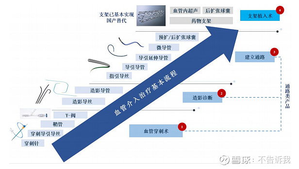 其中冠脉导引延伸导管和薄壁鞘(血管鞘组)为国产独家产品,微导管(冠脉
