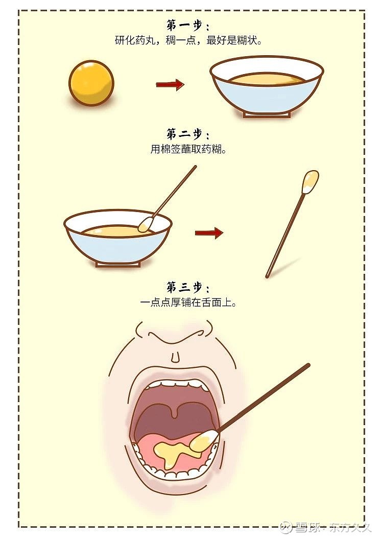 安宫牛黄丸服用方法大全,分享给更多需要的人!