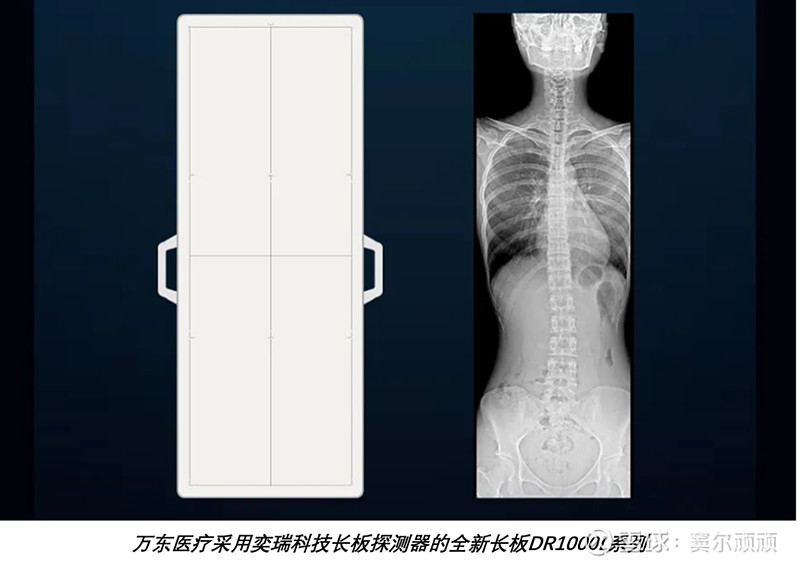 万东医疗:2021年DR销量1463套,市场份额远低于医招采数据统计 4月23日,影像设备上市公司 万东医疗 披露了其2021年的业绩报告 ...
