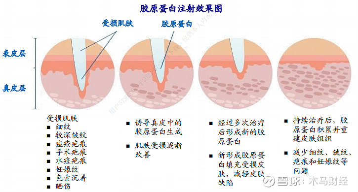 医美之胶原蛋白行业梳理 胶原蛋白简介胶原蛋白是构成动物生命基础的不溶性纤维型蛋白质,占人体总蛋白含量的25%~33%。除支撑塑形外,胶原蛋白还 ...