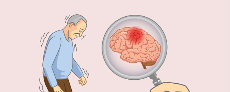 sci-110在阿尔兹海默病躁动患者iia期研究取得积极中期结果