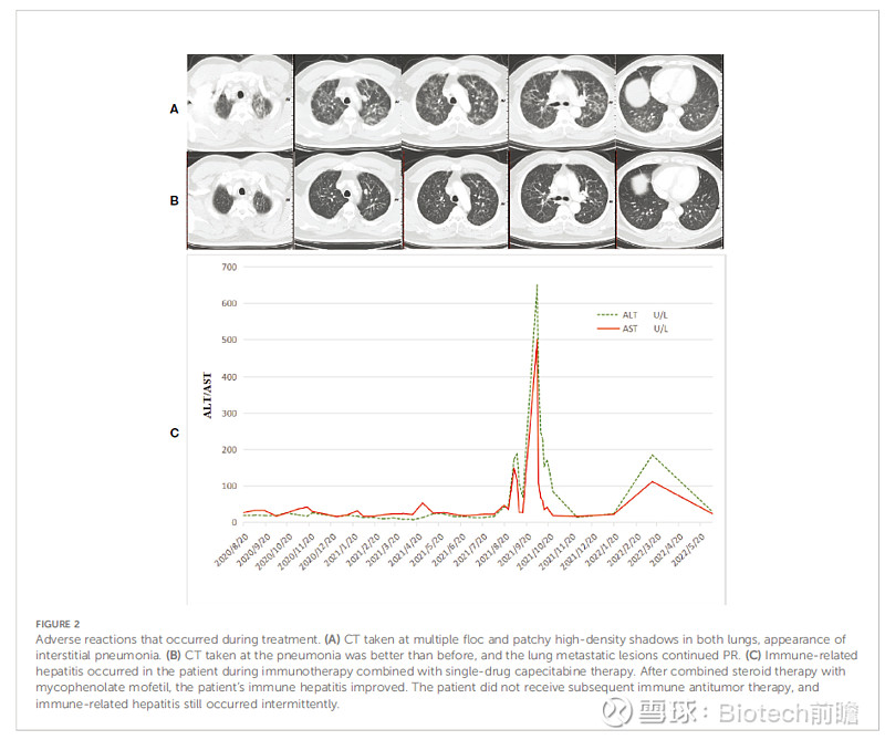 CR HER 2 Front Immunol Frontiers In 