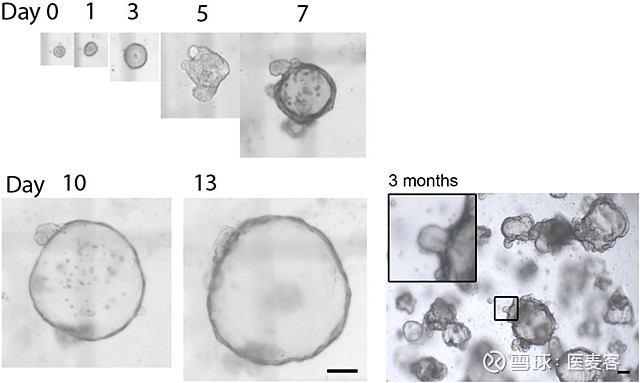 恺佧生物推出全新Wnt3a蛋白,助力类器官培养 类器官是在体外建立的与体内组织或器官高度相似的一种三维模型,能够再现已分化组织的复杂空间形态和 ...