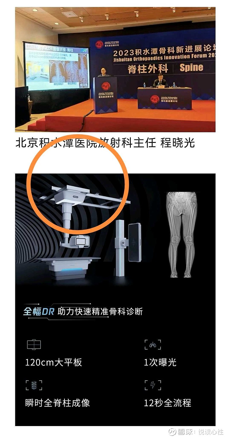 万东医疗——终于支棱起来了⭕ 网页链接 懒得跟你们说 万东医疗 太过低调。看看我的CBCT-DR，全球领先。看看我的数字胃肠机，全球领先。无液 ...