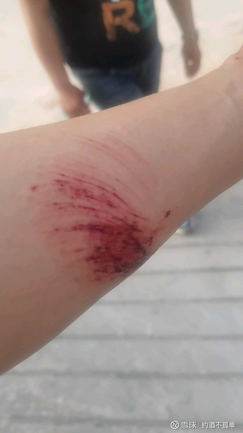 自己做的鱼缸新房子请师傅砌个烧柴火的灶台干活不小心擦伤了胳膊回顾