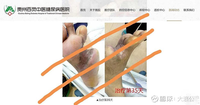 干嘛不用钱财呵护好自己的身体呢,所以可以预见未来三十年是糖宁通络