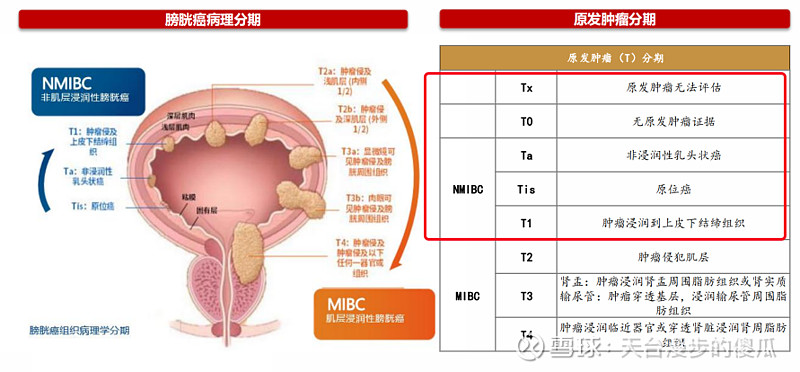 膀胱癌市场是不是个伪市场