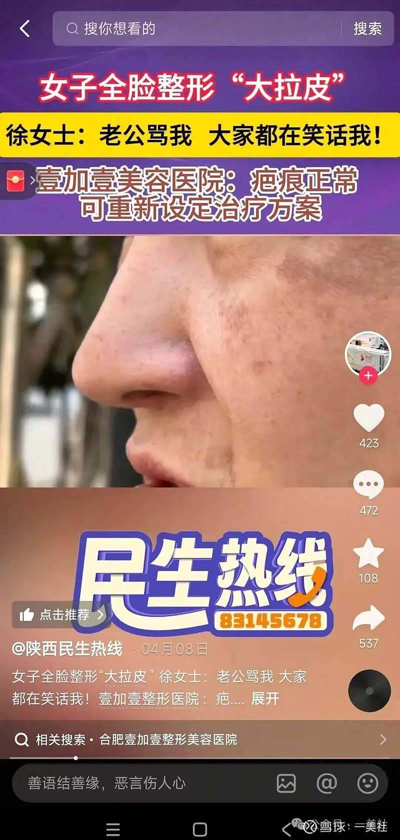 "黄金微针仪器"的壹加壹医美:严重的推销行为 两年内5次被罚(图3)